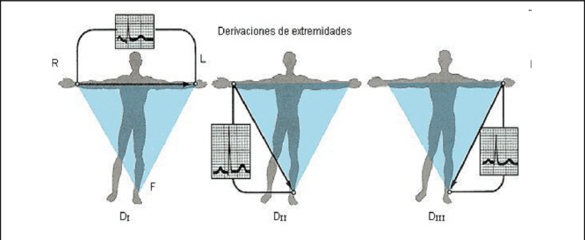 ¿Cuáles son las derivaciones bipolares de las extremidades?