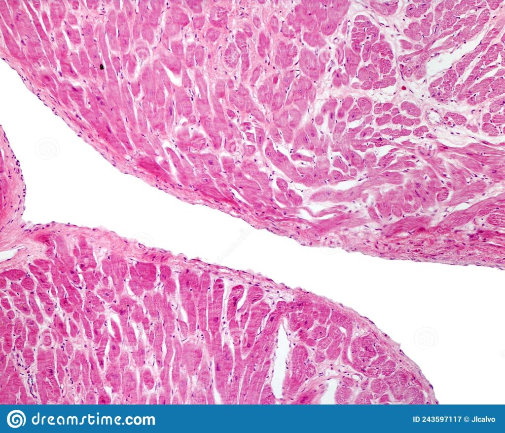 ¿Qué es el endocardio?