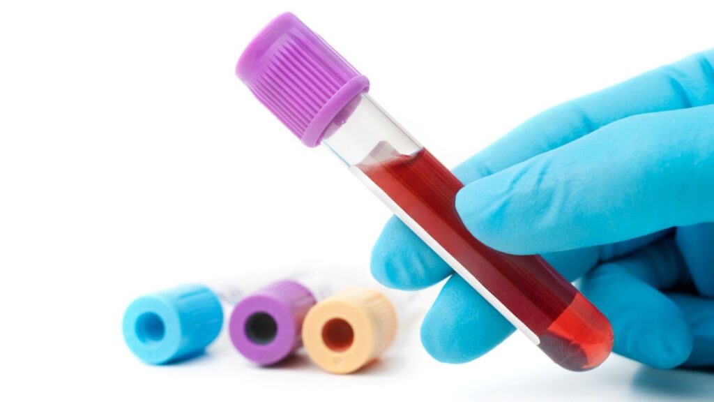 ¿Qué es una biometria hemática?