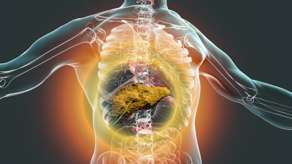 Clasificación de la cirrosis hepática de acuerdo a sus causas