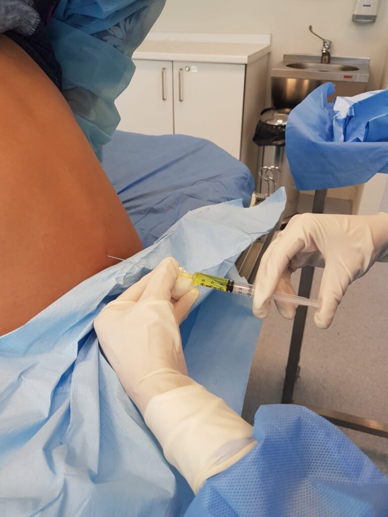 Administración intratecal de fármacos