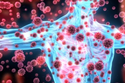 ¿Qué condiciones producen respuesta inflamatoria exagerada?