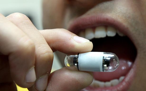 ¿Qué es la cápsula endoscópica?