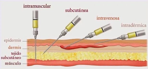 Ventajas de la administración parenteral de fármacos
