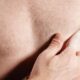 ¿Cuál es el riesgo de cáncer de mama en varones?