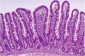 ¿Cuál es la función de la mucosa intestinal?