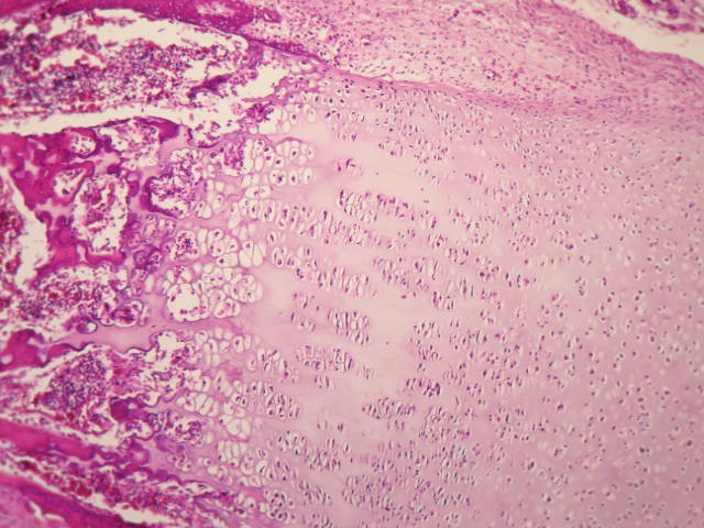 ¿Qué es la osificación?