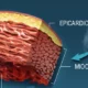 ¿Cuál es la función del epicardio?
