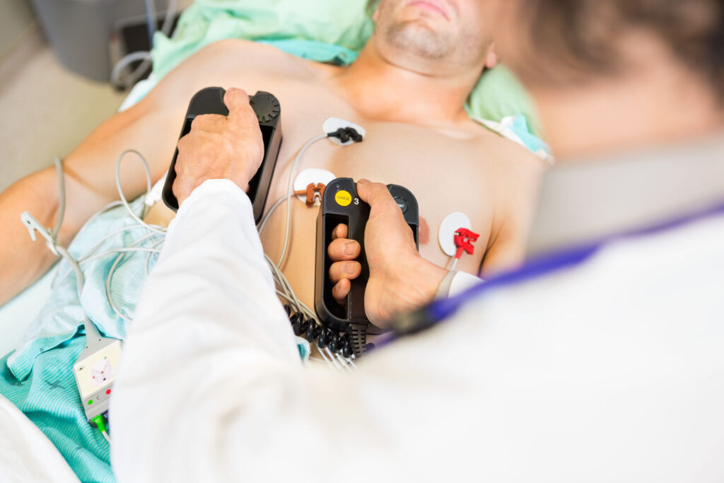 ¿Qué es el paro cardiorespiratorio?