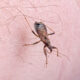 ¿Qué es la enfermedad de Chagas?