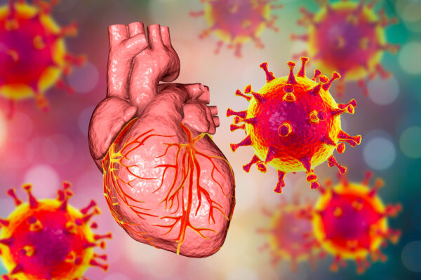 ¿Qué es la miocarditis infecciosa?