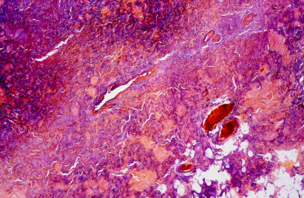 Matriz extracelular del cartílago fibroso