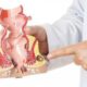 ¿Cuáles son las contraindicaciones para realizar una anoscopía?
