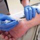 ¿Cuáles son las indicaciones para una punción arterial?
