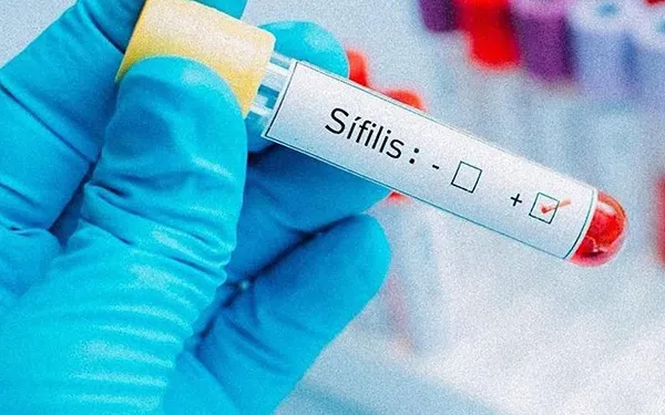 Tratamiento de la sífilis latente tardía o de duración indeterminada