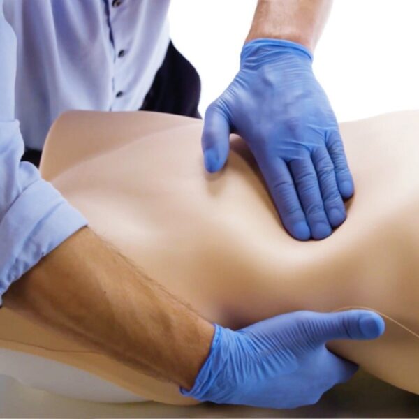 Utilidad de la palpación abdominal para detectar aneurismas