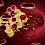 Epidemiología de las concentraciones de lipidos