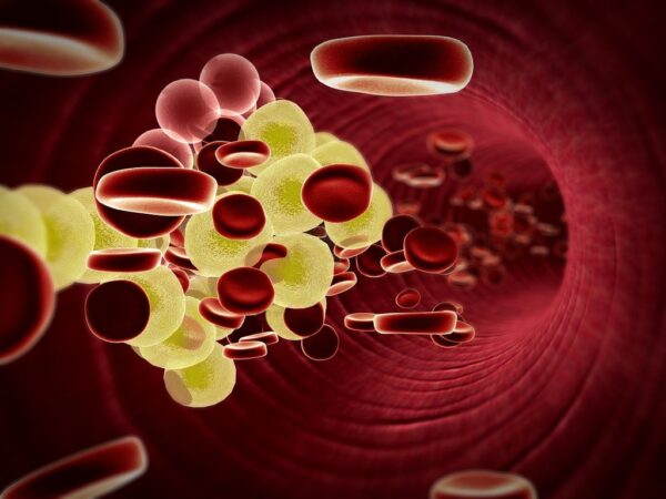 Epidemiología de las concentraciones de lipidos