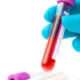 Detención de glucosa para conocer el riesgo cardiovascular
