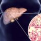 Influencia del alcohol en el metabolismo de los lípidos