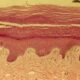 ¿Qué es la epidermis?