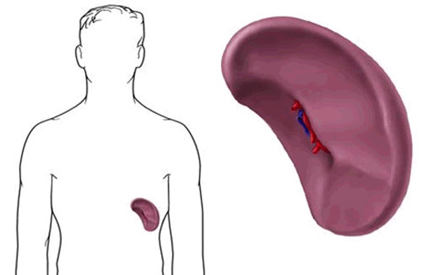 Hiperesplenismo en cirrosis alcohólica
