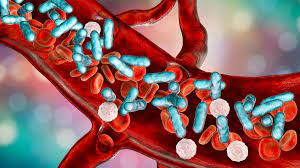 ¿Qué causa una respuesta inflamatoria sistémica?
