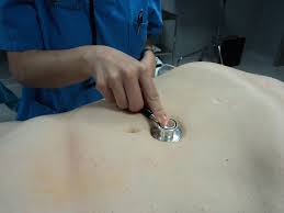 Exploración en pacientes con sospecha de aneurisma aórtico