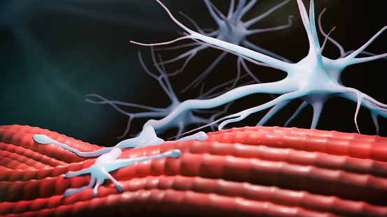 ¿Qué es el Síndrome miasténico (de Lambert-Eaton)?