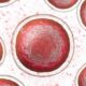 Célula precursora hematopoyética pluripotencial