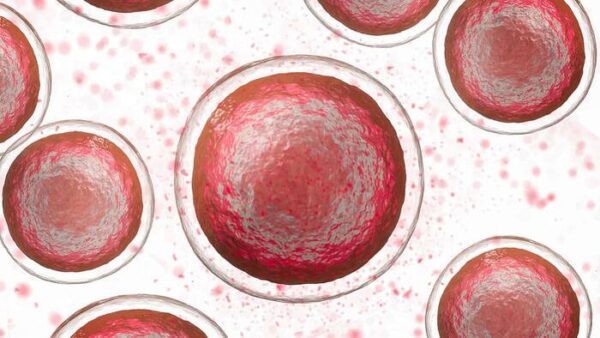 Anemia aplásica causada por radiación