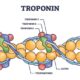 Troponina cardiaca
