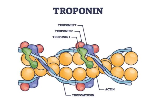 Troponina cardiaca