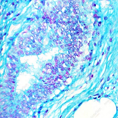 Microespectrofotometría de Feulgen