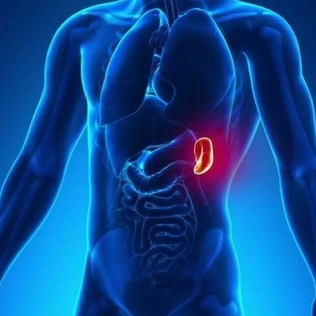 Eliminación de plaquetas en el bazo