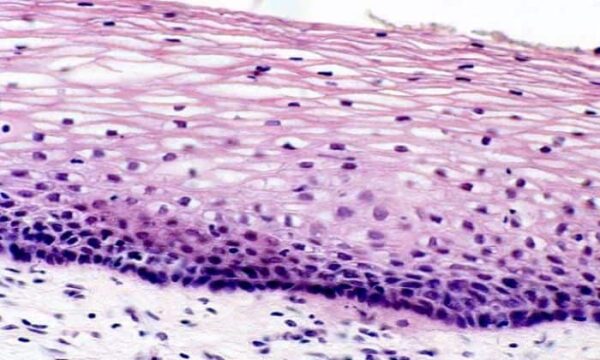 Tinción de fibras reticulares y membranas basales