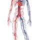 Mecanismos básicos de patología vascular