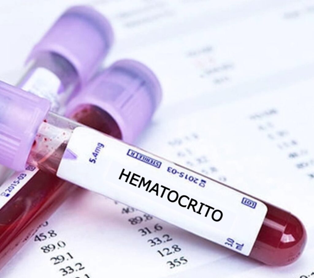 Valores bajos del hematocrito