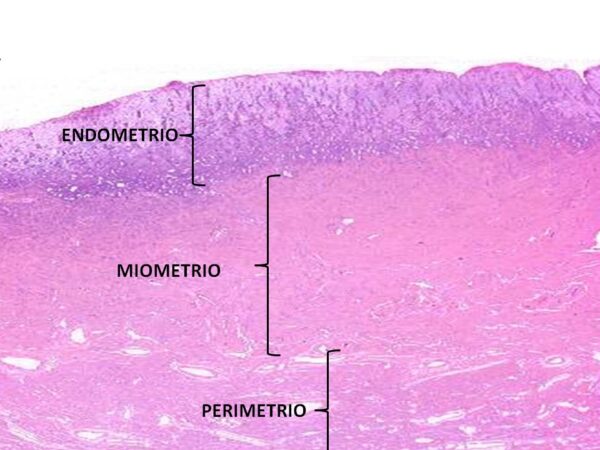 ¿Qué es el perimetrio?