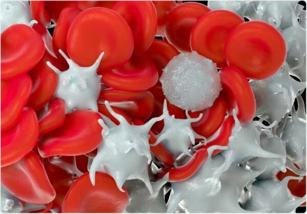 ¿Qué es la trombocitosis esencial?