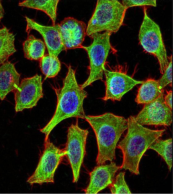 ¿Cuáles son los colorantes fluorescentes?