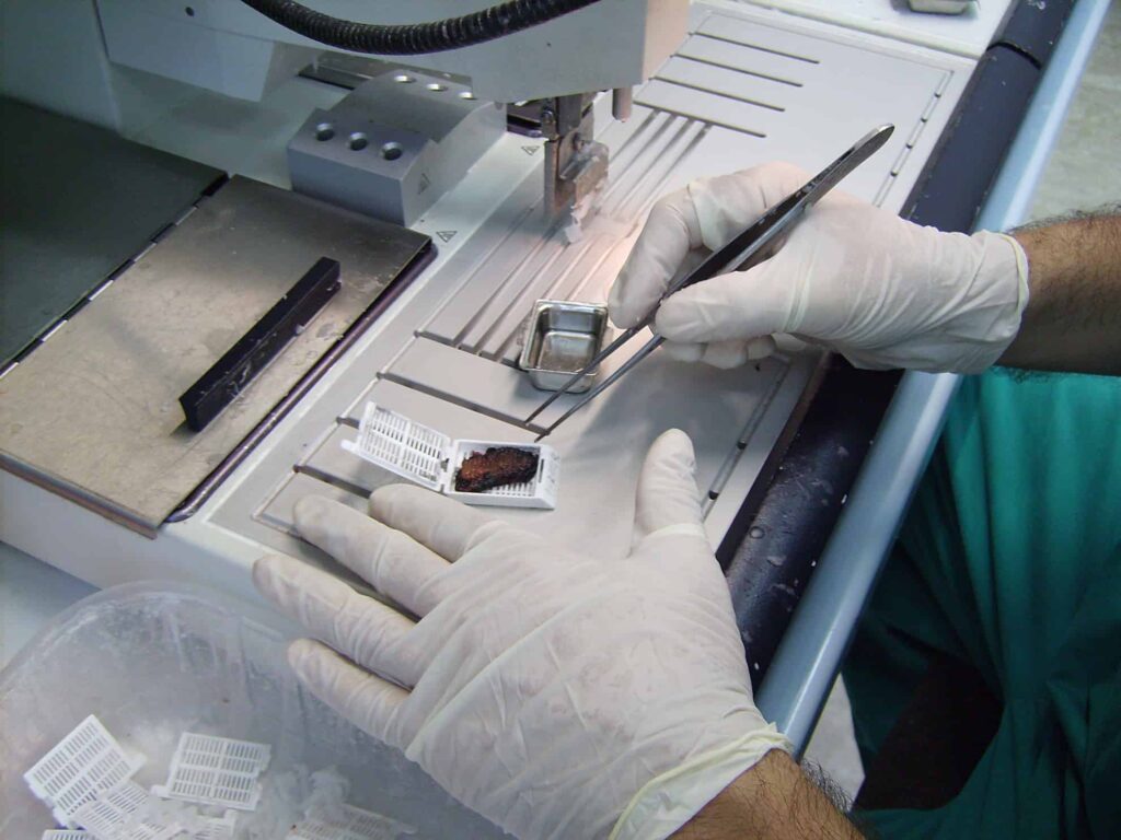 Medio de inclusión en muestras histológicas