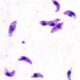 Pacientes más susceptibles adquirir toxoplasmosis
