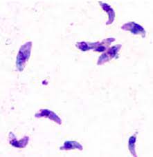 Pacientes más susceptibles adquirir toxoplasmosis