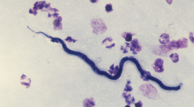 ¿Qué causa la oncocercosis?