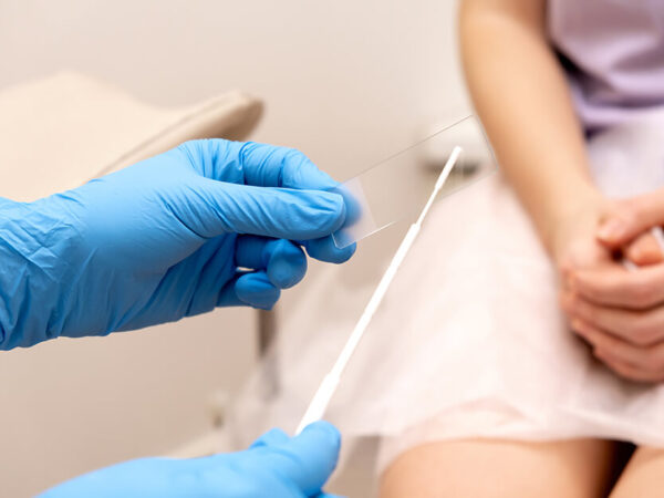 Examen rutinario del exudado vaginal