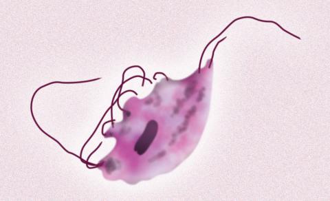 ¿Qué causa la tricomoniasis?