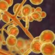 ¿Por qué han aumentado las infecciónes micóticas en el mundo?