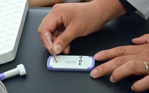 Pruebas de laboratorio para detectar VIH