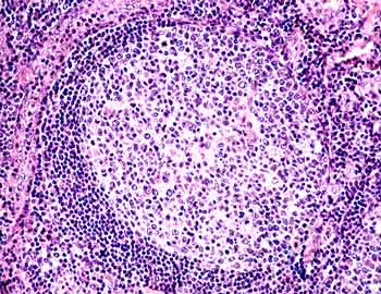 Organización del tejido linfático